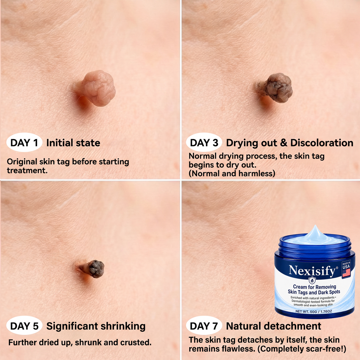 Nexisify® Advanced Correcting Cream