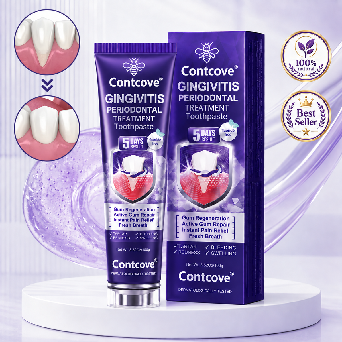 Contcove Gingivitis Periodontal Treatment Toothpaste