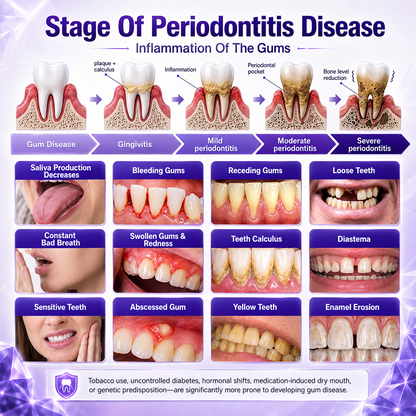 Contcove Gingivitis Periodontal Treatment Toothpaste