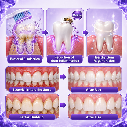 Contcove Gingivitis Periodontal Treatment Toothpaste
